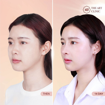 Slider image (3) The Art Clinic